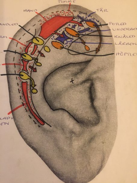 Zoner Öronakupunktur